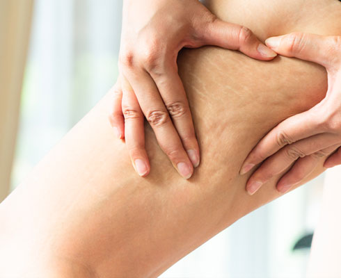 Toronto Lipolysis Injection Clinic  PRP (Platelet rich plasma therapy )