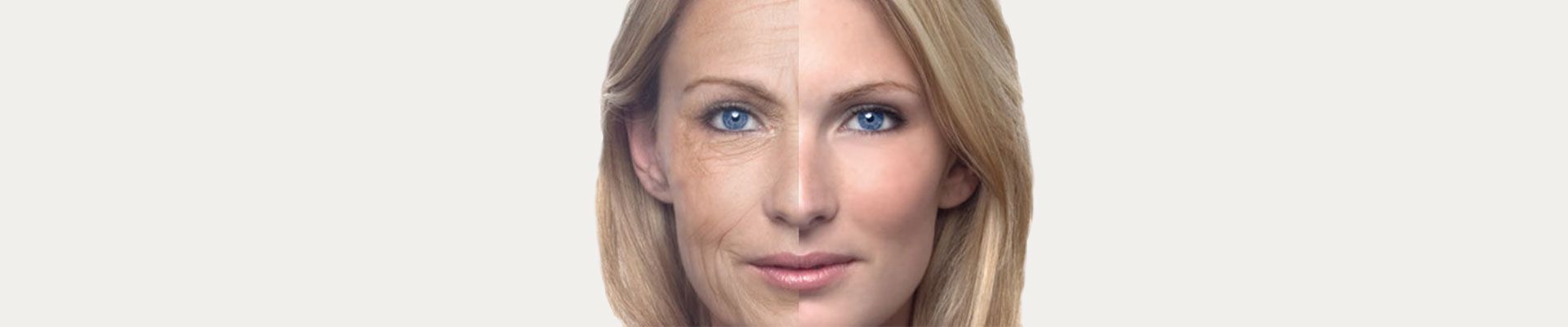 botox clinic toronto